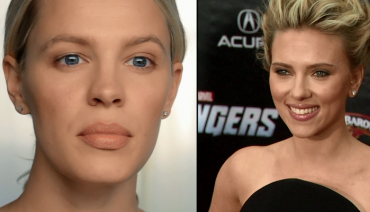 Scarlett Johansson’ın Dolgun Dudakları
