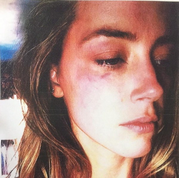 Amber Heard'dan Fiziksel Şiddet İddiası
