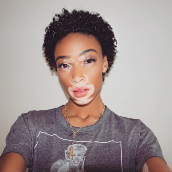 Winnie Harlow'un İlham Veren Pixie'si