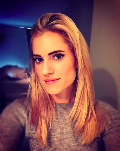 Allison Williams’ın Post-Ayrılık Saçları