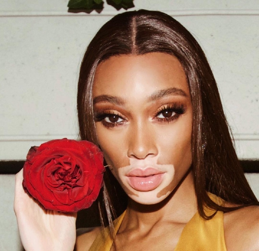 @winnieharlow