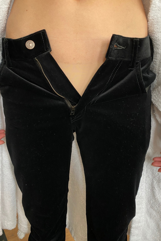 Örnek Beden Sorununa Işık Tutan Instagram Paylaşımı