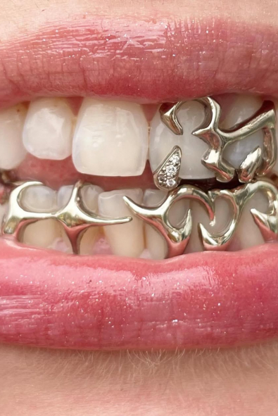 Grillz Modası Yeniden Yükselişte